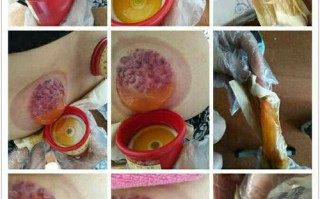 治疗链技能？怀旧服治疗链机制