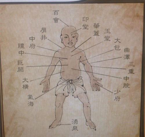 侠客风云传针灸攻略?侠客风云传胃疼针灸哪个位置?-第6张图片-93游戏 侠客风云传针灸攻略?侠客风云传胃疼针灸哪个位置?-第6张图片-93游戏